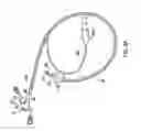 Fig. 04 - Feeding tube with inflatable balloon component