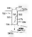 Fig. 01 - Lacrimal implants and related methods