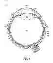 Fig. 02 - Lacrimal implants and related methods