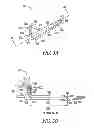 Fig. 04 - Lacrimal implants and related methods
