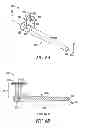 Fig. 06 - Lacrimal implants and related methods