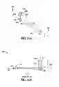 Fig. 09 - Lacrimal implants and related methods