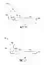 Fig. 10 - Lacrimal implants and related methods