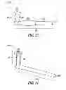 Fig. 11 - Lacrimal implants and related methods
