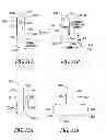 Fig. 15 - Lacrimal implants and related methods