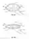 Fig. 13 - COVER FOR AN ATRAUMATIC CATHETER HUB AND A METHOD FOR ITS USE