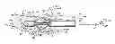 Fig. 01 - Injection molded adjustable shape abscess irrigation device