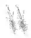 Fig. 02 - Injection molded adjustable shape abscess irrigation device