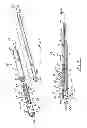 Fig. 03 - Injection molded adjustable shape abscess irrigation device