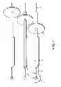 Fig. 06 - Automated, selectable, soft tissue excision biopsy devices and methods