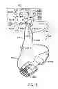 Fig. 02 - SYSTEMS, APPARATUS, METHODS AND PROCEDURES FOR THE NON-INVASIVE TREATMENT OF TISSUE USING MICROWAVE ENERGY