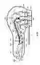 Fig. 23 - SYSTEMS, APPARATUS, METHODS AND PROCEDURES FOR THE NON-INVASIVE TREATMENT OF TISSUE USING MICROWAVE ENERGY