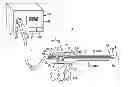 Fig. 01 - SURGICAL OPERATION SYSTEM