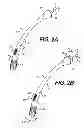 Fig. 03 - Apparatus for treating a portion of a reproductive system and related methods of use