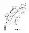 Fig. 04 - Apparatus for treating a portion of a reproductive system and related methods of use