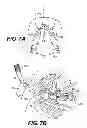 Fig. 09 - Apparatus for treating a portion of a reproductive system and related methods of use