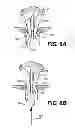 Fig. 10 - Apparatus for treating a portion of a reproductive system and related methods of use
