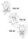 Fig. 11 - Apparatus for treating a portion of a reproductive system and related methods of use