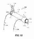Fig. 17 - Apparatus for treating a portion of a reproductive system and related methods of use