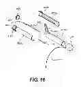Fig. 18 - Apparatus for treating a portion of a reproductive system and related methods of use