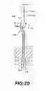 Fig. 22 - Apparatus for treating a portion of a reproductive system and related methods of use
