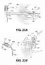 Fig. 25 - Apparatus for treating a portion of a reproductive system and related methods of use
