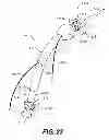Fig. 26 - Apparatus for treating a portion of a reproductive system and related methods of use