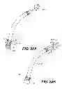 Fig. 27 - Apparatus for treating a portion of a reproductive system and related methods of use