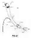 Fig. 30 - Apparatus for treating a portion of a reproductive system and related methods of use