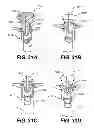 Fig. 34 - Apparatus for treating a portion of a reproductive system and related methods of use