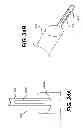 Fig. 37 - Apparatus for treating a portion of a reproductive system and related methods of use