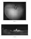 Fig. 23 - Electrosurgical Plenum