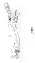 Fig. 05 - Surgical Fasteners Including Nanomaterial Coating for Applying Pulsed Current