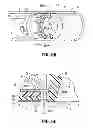 Fig. 07 - Surgical Fasteners Including Nanomaterial Coating for Applying Pulsed Current