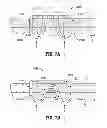 Fig. 10 - Surgical Fasteners Including Nanomaterial Coating for Applying Pulsed Current