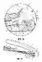 Fig. 08 - Pediatric combination surgical device