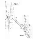 Fig. 07 - Tissue fusion system, apparatus and method