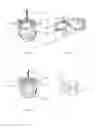 Fig. 02 - SURGICAL RASP