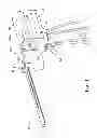 Fig. 02 - Surgical sagittal saw blade assembly that includes a guide bar including bottom, inner and outer bars and a blade head that pivots around the inner bar