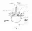 Fig. 02 - Tissue modification devices