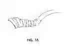 Fig. 17 - Tissue modification devices