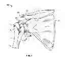 Fig. 02 - Patient-specific cutting guide for the shoulder