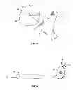 Fig. 06 - Patient-specific cutting guide for the shoulder