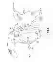 Fig. 08 - Patient-specific cutting guide for the shoulder