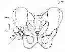 Fig. 01 - Devices and methods for hip replacement