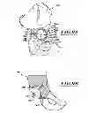 Fig. 10 - Devices and methods for hip replacement