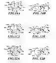 Fig. 11 - Devices and methods for hip replacement