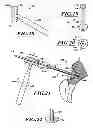 Fig. 17 - Devices and methods for hip replacement