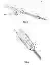 Fig. 02 - Instrument and method for provisionally locking a polyaxial screw