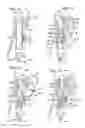 Fig. 07 - TRANSESOPHAGEAL GASTRIC REDUCTION METHOD AND DEVICE FOR REDUCING THE SIZE OF A PREVIOUSLY FORMED GASTRIC REDUCTION POUCH